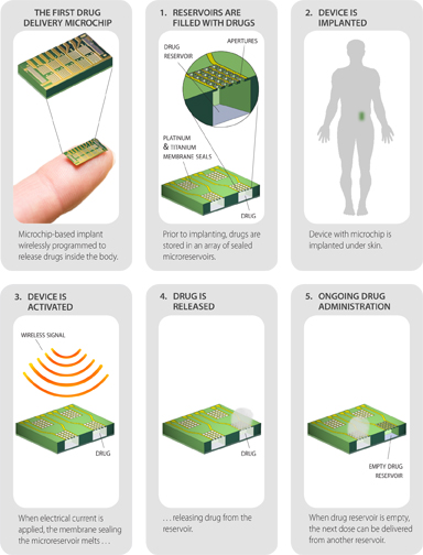 Pilule contraceptive - technology_infographic